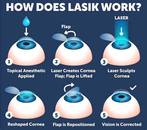lasik eye surgery coldwater ms Products and services LASIK surgery: Is it right for you? LASIK eye
